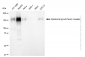 KD-Validated Anti-Epidermal Growth Factor Receptor Rabbit Monoclonal Antibody